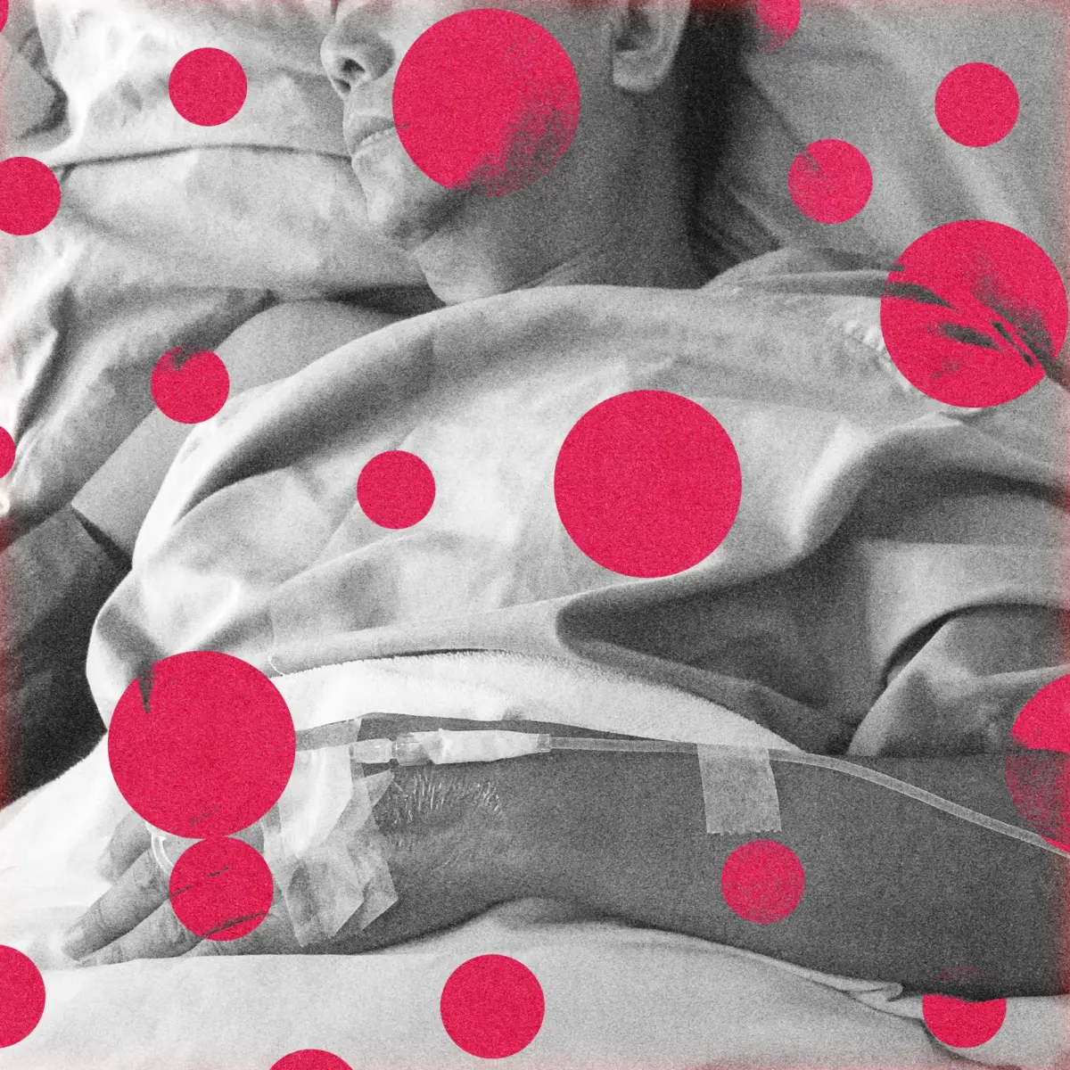 America’s Measles Crisis: Historic Outbreaks Spark National Debate as Pennsylvania Records First US Deaths of 2026