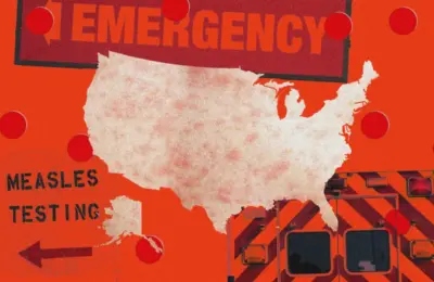 Resurgence of a Forgotten Threat: How US Hospitals Are Adapting to Historic Measles Outbreaks
