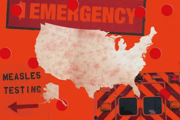 Resurgence of a Forgotten Threat: How US Hospitals Are Adapting to Historic Measles Outbreaks