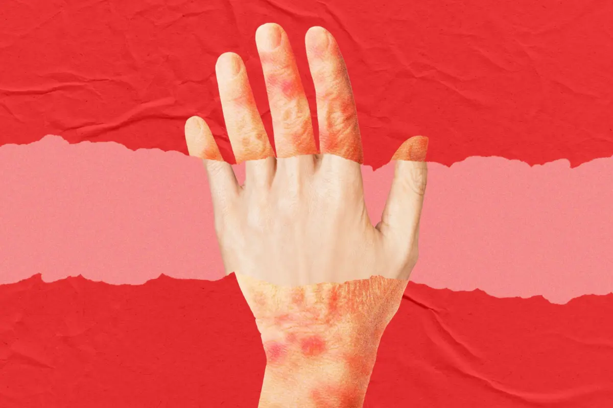 The Fountain of Youth in a Cream: How Biotech Is Turning Back the Biological Clock on Skin Aging